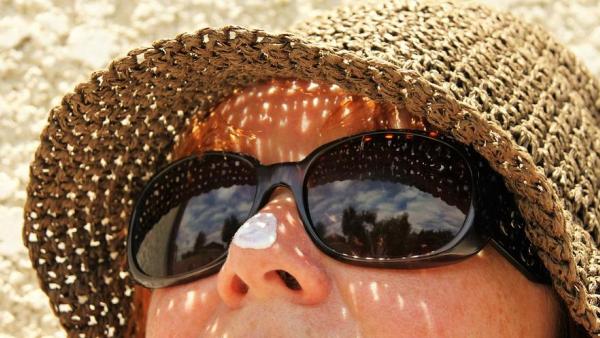 Слънчево изгаряне - симптоми и лечение на кожата