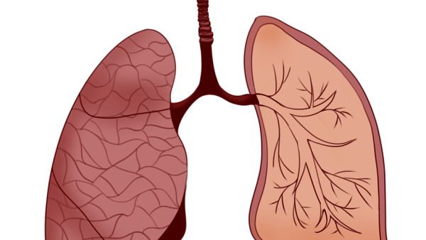 Хроничната обструктивна белодробна болест  (ХОББ) и функцията на белите дробове