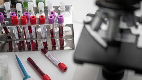 Колко време отнема получаването на резултатите от различни кръвни тестове