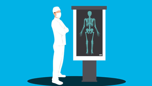 Изследване на костната плътност (дензитометрия) - какво трябва да знаем