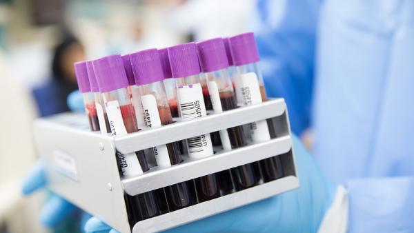 Среден корпускуларен хемоглобин (MCH) - какво трябва да знаем за кръвния тест