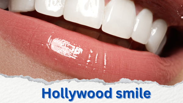 Сияйната Холивудска Усмивка: Всичко, което трябва да знаете за естетичната стоматология