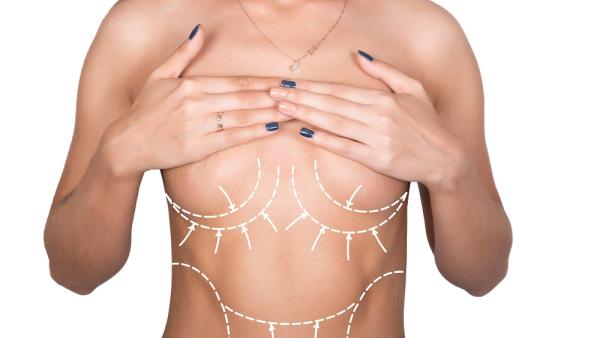 5 предимства на гръдните имплантанти