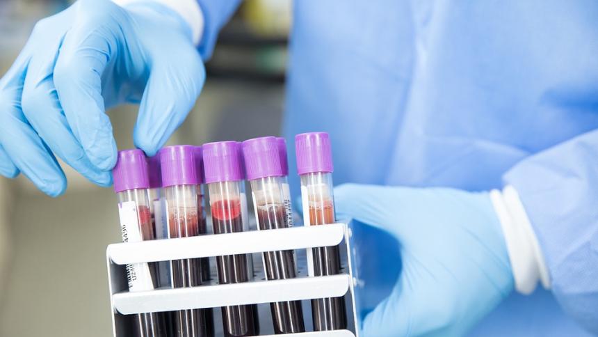 Аминокиселината хомоцистеин - причини за високи стойности и кога се назначава кръвен тест