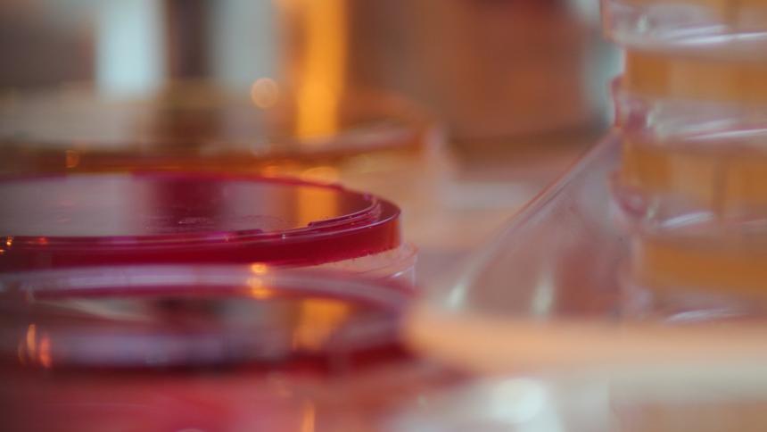 Хемокултура (посявка на кръв в микробна среда)  - какво трябва да знаем за изследването