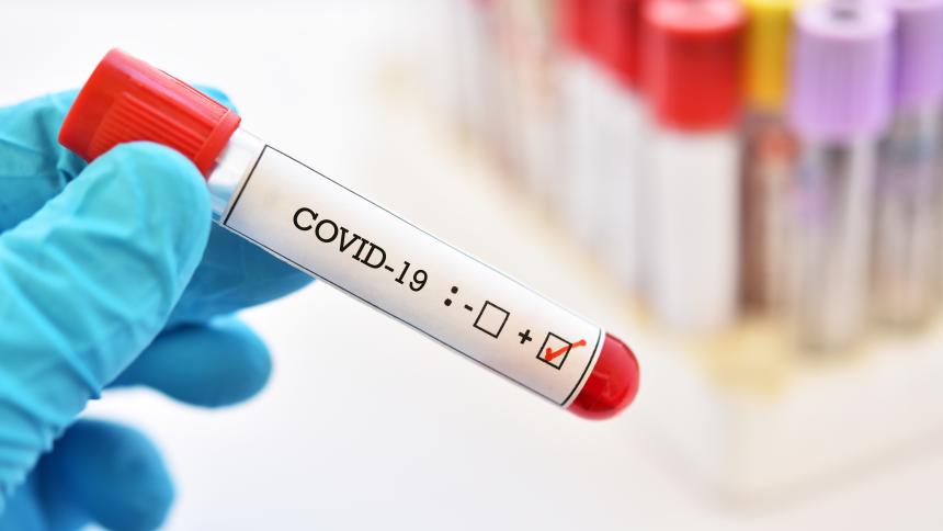 Какво трябва да знаем за тестовете за антитела и COVID-19