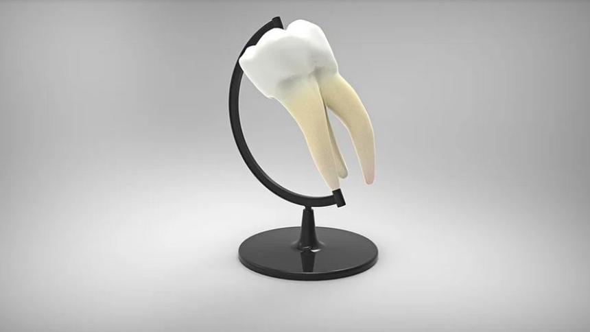 Зъбните импланти - какво да очакваме