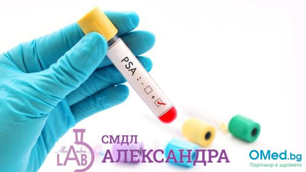 PSA - туморен маркер на простата за 10 лв. от СМДЛ "Александра"