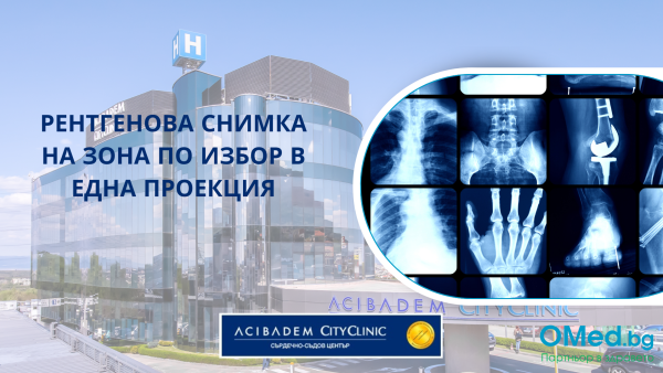 Рентгенова снимка на зона по избор в една проекция в Аджибадем Сити Клиник Сърдечно-съдов център! Не отлагайте!