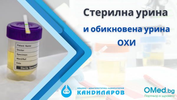 Стерилна урина и обикновена урина ОХИ от Лаборатории Кандиларов!