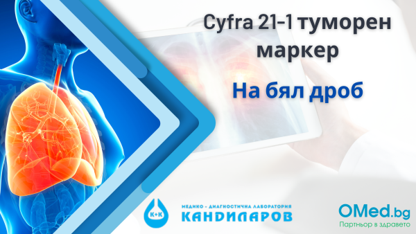 Cyfra 21-1 туморен маркер за бял дроб от Лаборатории "Кандиларов"