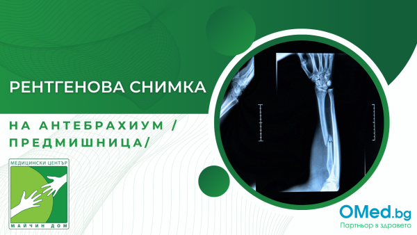 Рентгенова снимка на антебрахиум /предмишница/ за 25 лв. от МЦ "Майчин дом"