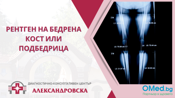 Рентген на бедрена кост или подбедрица от ДКЦ "Александровска"