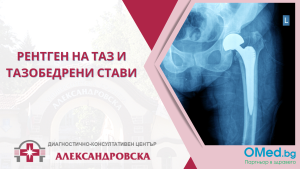 Рентген на таз и тазобедрени стави от ДКЦ "Александровска"