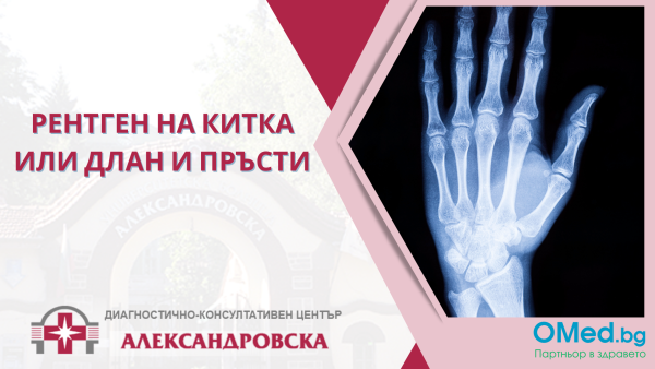 Рентген на китка или длан и пръсти от ДКЦ "Александровска"