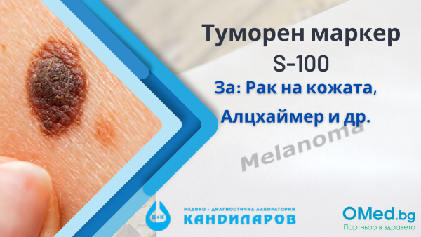 Туморен маркер S-100 от Лаборатории "Кандиларов"
