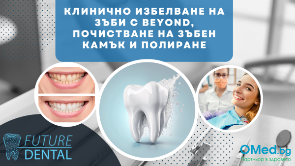 Клинично избелване на зъби с Beyond,  почистване на зъбен камък и полиране от Фючър Дентал Клиника