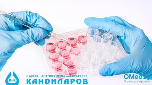 ДНК тест за Chlamydia trachomatis  Лаборатории Кандиларов!