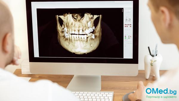 Дигитална панорамна рентгенова снимка на зъби на последно поколение апарат за 18 лв. от Стоматологична практика Съни Дент!