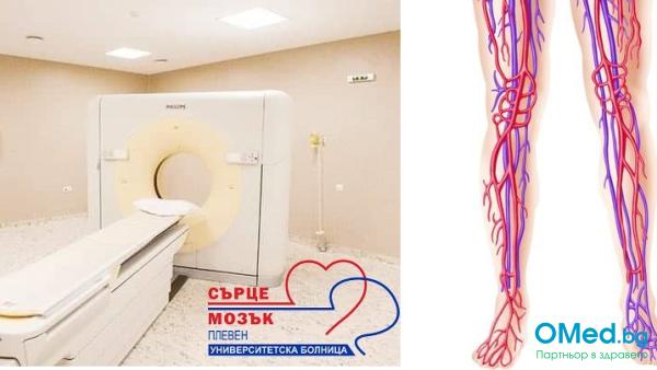 Периферни съдове! Изследване с компютърен томограф (скенер) от УМБАЛ Сърце и Мозък гр. Плевен
