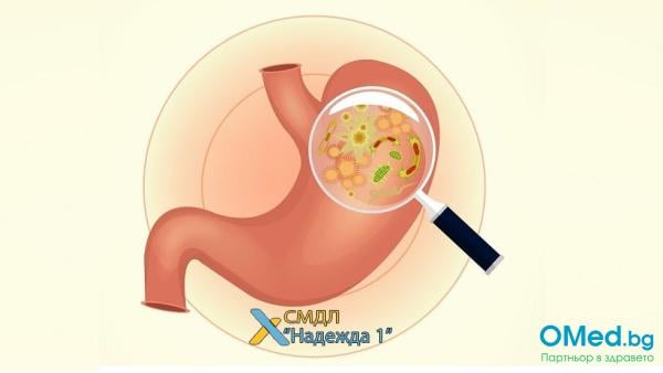 Изследване на Хеликобактер пилори, кръвен или във фецес на цени от 8 лв., от СМДЛ "Надежда 1"