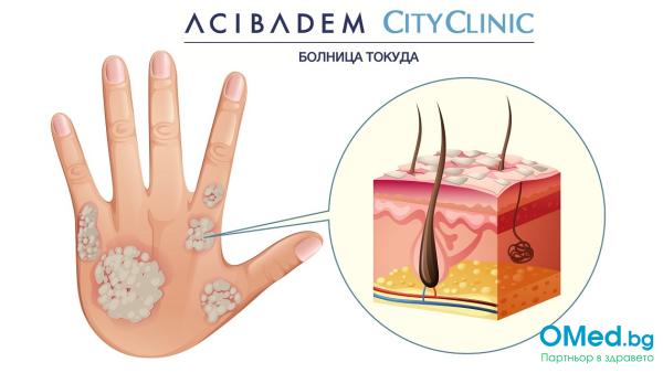 Първичен преглед от лекар дерматолог от Аджибадем Сити Клиник ДКЦ Токуда