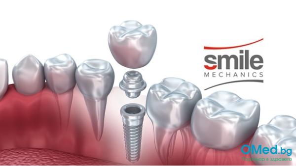 ПЪЛЕН ПАКЕТ! Поставяне на зъбен имплант + надстройка + корона  от SM Clinic!