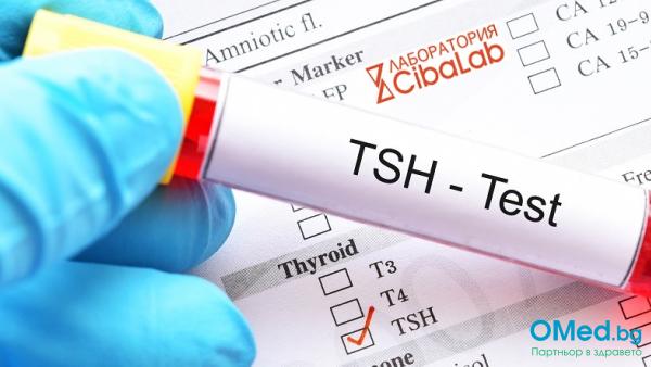 Изследване на хормонa TSH от лаборатории Cibalab!