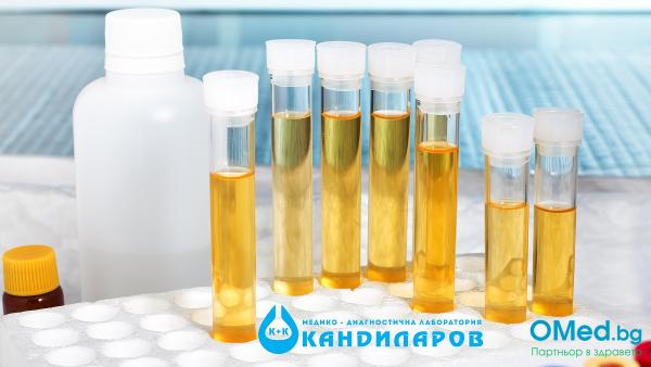 Стерилна урина, обикновена урина и ПКК от Лаборатории Кандиларов!