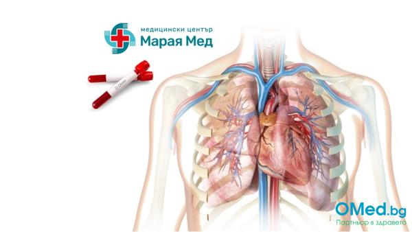 Първичен преглед при кардиолог, ЕКГ, ехография на сърце и Д-димер за 90 лв. от МЦ Марая Мед