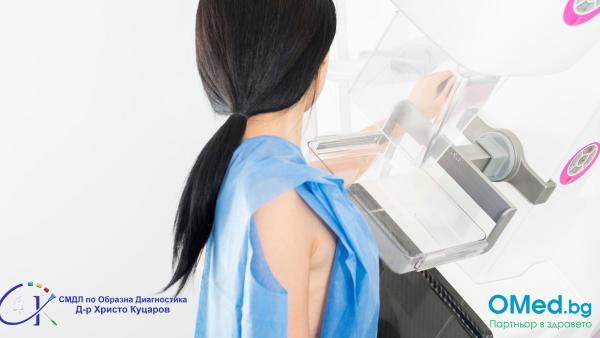 Дигитална мамография в 4 проекции за жени над 40 години СМДЛ по Образна Диагностика Д-р Христо Куцаров