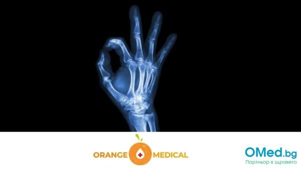 Рентгенова снимка на длан и пръсти за 25 лв. от МЦ Ориндж